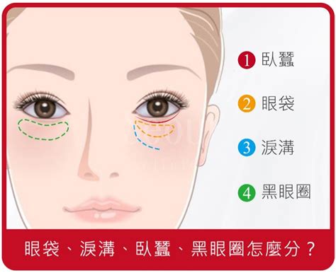 眼袋臥蠶面相|臥蠶、淚溝、眼袋、黑眼圈怎麼分？一篇讓你看懂如何有效消除眼。